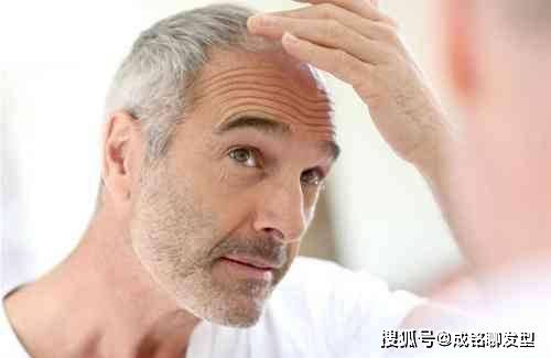 染发可以让人年轻,为什么很多头发花白发的中年男士都不染发了