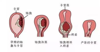 产后恢复得好不好,看这7个指标,不落病根