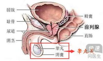 男性睾丸炎怎么治疗效果好