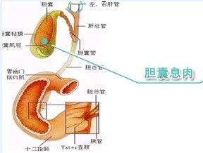 我也是胆囊息肉,请问你现在好了吗 求回复 