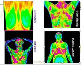 热成像检查医生