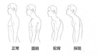 颈纹显老 以下小妙招教你预防颈纹