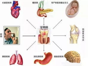 雷叔有货丨口腔细菌克星,嘴里的香气炸弹,从此告别口臭 黄牙