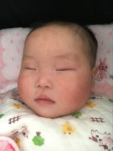 3月大婴儿干性湿疹,三个月宝宝脸上有湿疹怎么办