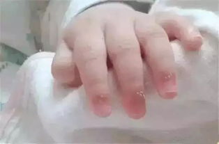 月嫂说 你们这样做宝宝很受伤,关于新生儿剪指甲的三大误区你都了解吗 