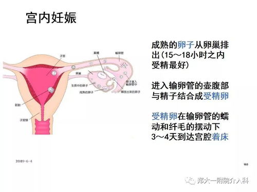 妇产疾病的介入治疗