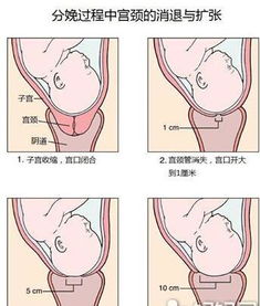 分娩时的 开十指 是什么意思