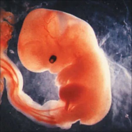 怀孕3个月胎儿图(怀孕三个月的胎儿是什么样子的)
