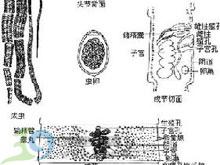 复孔绦虫病