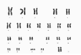 二胎放开了 准备怀孕的你 孕前染色体检查 了解吗 图