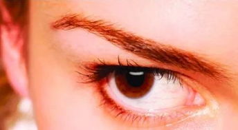 为什么你的眼睛总是很多红血丝 可能是因为这些原因 