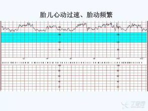 胎心率180(胎儿心跳180正常吗)