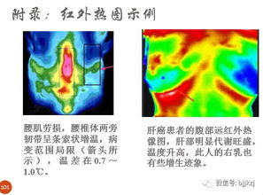 探究红外线热成像的应用与技术特点