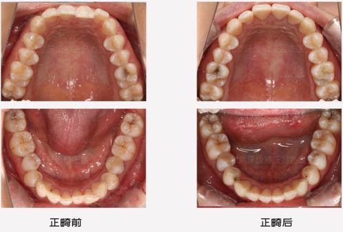 哔哩哔哩专栏 