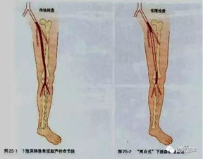 下肢深静脉的超声检查