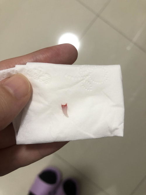 猫指甲掉了 带血的 正常吗 