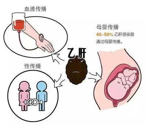 乙肝会通过父母传给孩子吗