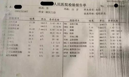 乙肝病毒量达到多少就需要抗病毒治疗