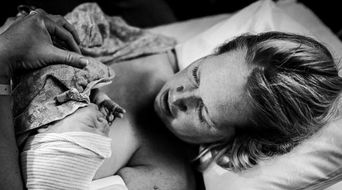 摄影师拍到到刚出生婴儿头部被挤压变形, 恐怖医生还说正常