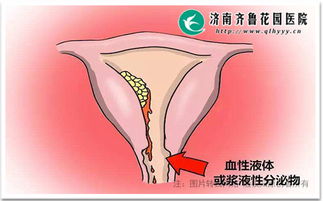 怀孕后阴道流血.跟月经有什么区别?