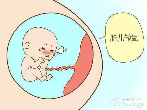 原创胎儿缺氧要怎么办