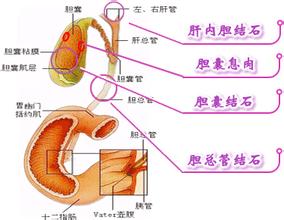 胆囊息肉都有什么症状