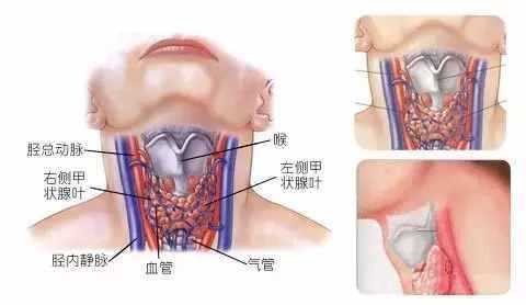 锁骨疼痛和甲状腺有关系吗,甲状腺功能异常与锁骨疼痛的可能联系