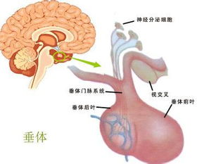 垂体瘤为什么会复发转移 