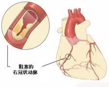 心脏病的症状有哪些呢(心脏病的症状都有什么)