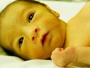 新生儿黄疸高老是吐奶,满月小孩黄疸吐奶
