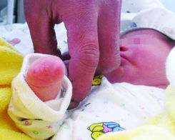 刚出生的婴儿没右手 曾做4次B超没查出异常 