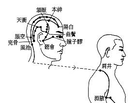 偏头痛 率谷穴 下篇 具体针法 非常非常实用且有效的操作方法