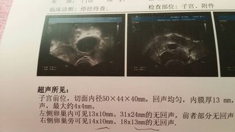 彩超见：子宫前位，切面形态正常-大小44x28x45MM，肌层回声均匀，内膜居中，厚约8MM，内回声分布均匀-宫内未见明显占位性病变.双侧附件未见明显局限性光团回声.医生说我没卵泡