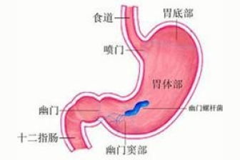 慢性非萎缩性胃炎伴胃窦糜烂能不能完全治好 