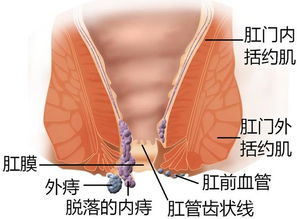 蝌蚪五线谱 便血惊魂 一场激烈的内讧