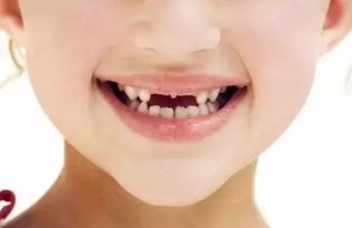 宁波家长们 小孩子牙齿畸形的原因竟是这个 警惕这几个不良习惯 