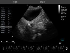 兽用B超机在畜牧生产上的应用