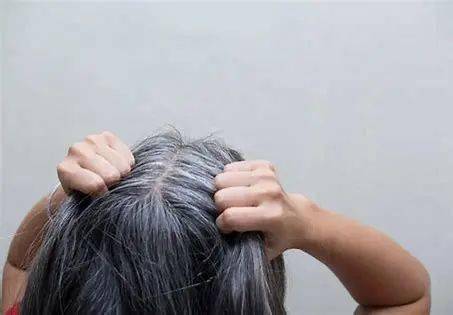 为什么压力大时会长白头发 这些习惯可能会催生白发