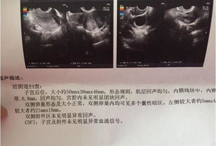 命中注定有子,做了两次试管才成功,好孕 