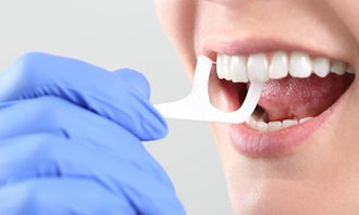 牙龈出血可能是白血病等血液病的表现