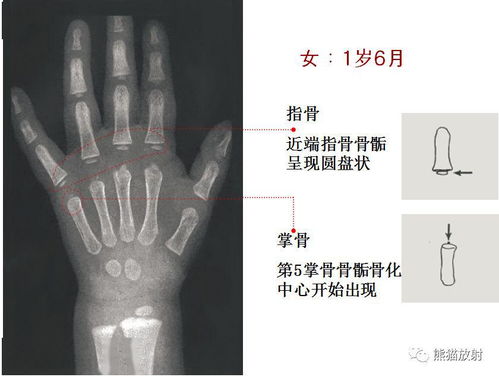 收藏丨骨龄图谱 方便随时对照