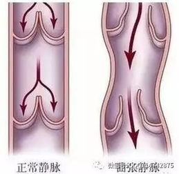 头上的筋结怎么消除(头上长筋)