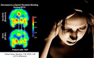 科学家发现大脑受电击后能释放出最有效止痛剂
