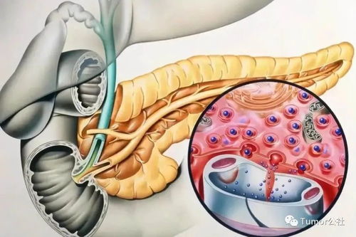 27岁网红突发胰腺炎离世 胰腺炎为啥如此凶险