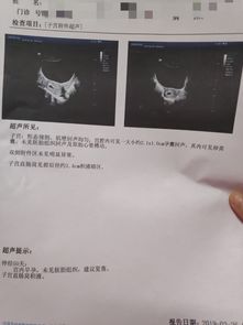 8周没有胎心胎芽怎么补救,8周无胎心胎芽