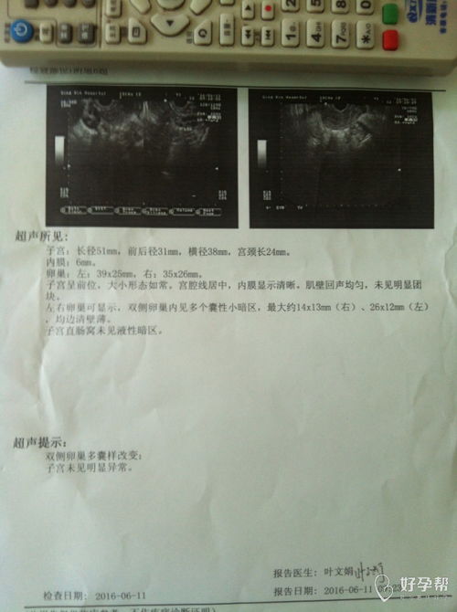 终于没事,幸好没做手术