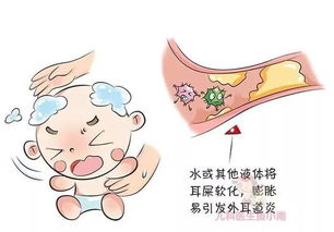 宝宝耳朵鼓膜图片 搜狗图片搜索