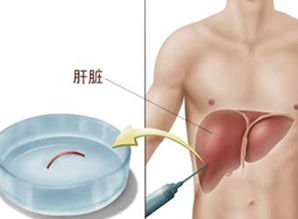 肝积水的原因 肝积水的表现 肝积水的治疗方法 症状查询 久久健康网 