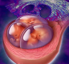 试管单胚胎双胎几率：梦想成为现实的可能性