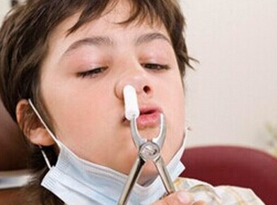 过敏性鼻炎可以做隆鼻吗